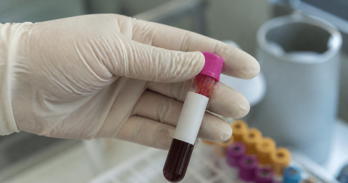 Flacon de sang prélevé avec étiquette de laboratoire