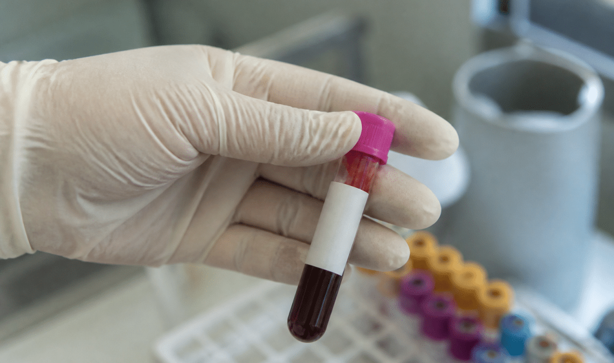 Flacon de sang prélevé avec étiquette de laboratoire